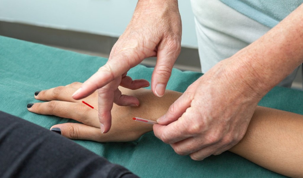 Healing Points-acupuncture for overall health